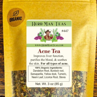 ACNE TEA Organic Herbal Blend to Support Clear Skin & Complexion 100% Organic
